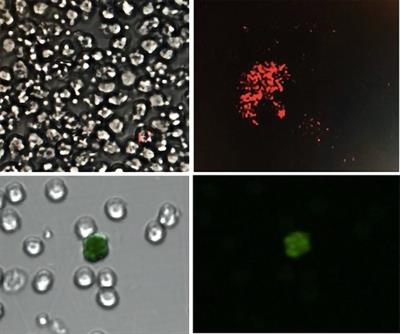 Pulmonary arterial hypertension in children with congenital heart disease: a deeper look into the role of endothelial progenitor cells and circulating endothelial cells to assess disease severity